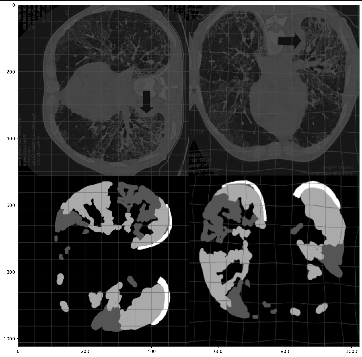 Original and augmented images
